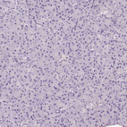 Immunohistochemical staining of human pancreas shows no positivity in exocrine glandular cells as expected.