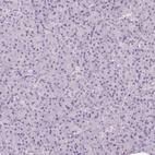 Immunohistochemical staining of human pancreas shows no positivity in exocrine glandular cells as expected.