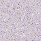 Immunohistochemical staining of human liver shows no positivity in hepatocytes as expected.