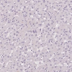 Immunohistochemical staining of human liver shows no positivity in hepatocytes as expected.