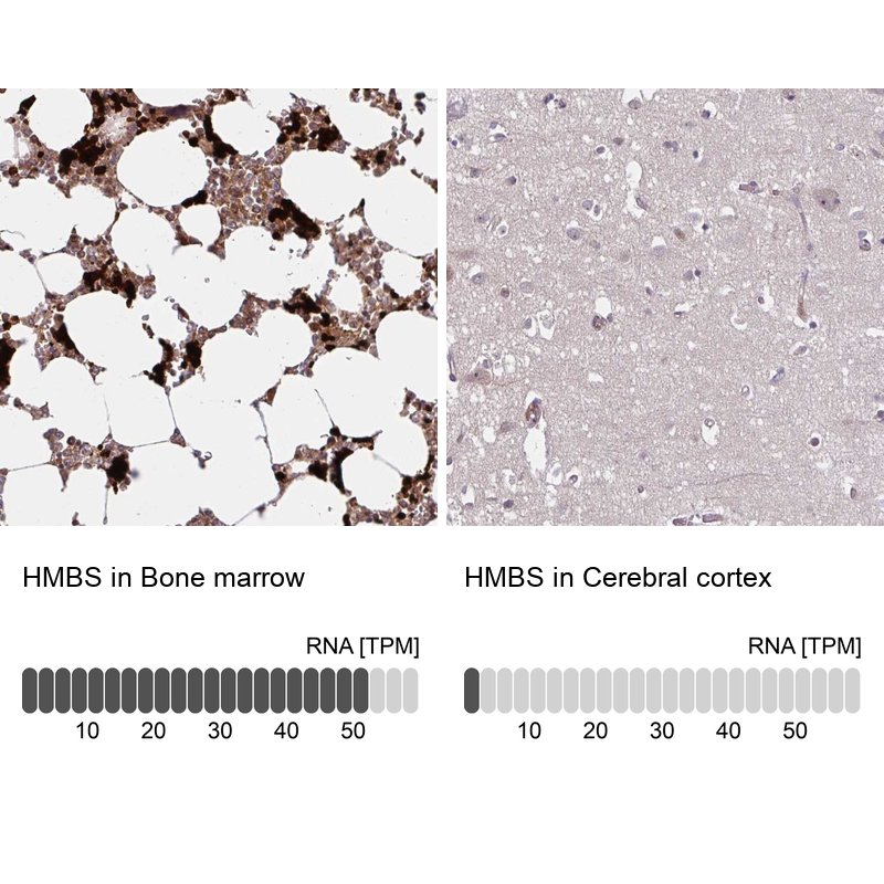 Anti-HMBS Antibody