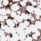 Immunohistochemical staining of human bone marrow shows high expression.