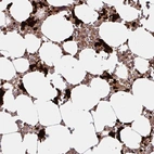 Immunohistochemical staining of human bone marrow shows high expression.