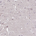 Immunohistochemical staining of human cerebral cortex shows low expression as expected.