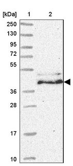 Lane 1: Marker [kDa] 250, 130, 95, 72, 55, 36, 28, 17, 10_br/_Lane 2: Human cell line RT-4