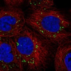 Immunofluorescent staining of human cell line A-431 shows localization to lipid droplets.