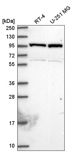 Anti-NAA15 Antibody