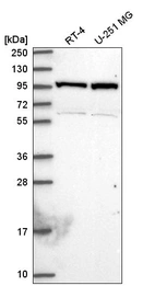 Anti-NAA15 Antibody