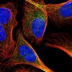 Immunofluorescent staining of human cell line U-2 OS shows localization to cytosol.