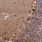 Anti-PCED1A Antibody