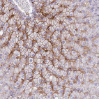 Anti-SLCO1B3 Antibody