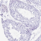 Immunohistochemical staining of human testis shows no positivity in cells in seminiferous ducts as expected.