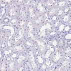 Immunohistochemical staining of human kidney shows no positivity in cells in tubules as expected.