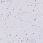 Anti-SLCO1B3 Antibody