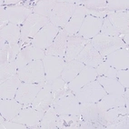 Immunohistochemical staining of human skeletal muscle shows no positivity in myocytes as expected.