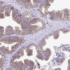 Immunohistochemical staining of human prostate shows moderate to strong cytoplasmic positivity in glandular cells.