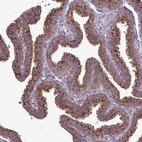 Immunohistochemical staining of human fallopian tube shows moderate to strong cytoplasmic positivity in glandular cells.