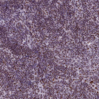 Anti-SRSF4 Antibody