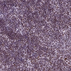 Immunohistochemical staining of human lymph node shows moderate to strong nuclear positivity in non - germinal center cells.