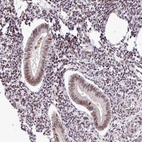 Immunohistochemical staining of human endometrium shows moderate to strong nuclear positivity in glandular cells.