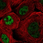 Immunofluorescent staining of human cell line A-431 shows localization to nuclear speckles.
