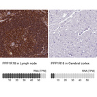 Anti-PPP1R18 Antibody