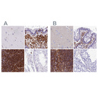Immunohistochemical staining of human cerebral cortex, colon, lymph node and testis using Anti-PPP1R18 antibody HPA051000 (A) shows similar protein distribution across tissues to independent antibody HPA044745 (B).