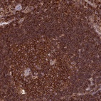 Anti-PPP1R18 Antibody