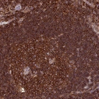 Immunohistochemical staining of human lymph node shows high expression.