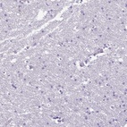 Anti-PPP1R18 Antibody