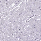Immunohistochemical staining of human cerebral cortex shows low expression as expected.