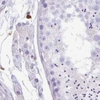 Immunohistochemical staining of human testis using Anti-PPP1R18 antibody HPA051000.