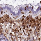 Immunohistochemical staining of human colon using Anti-PPP1R18 antibody HPA051000.