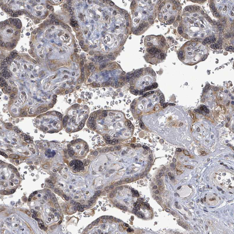 Anti-ARFGAP1 Antibody