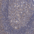 Immunohistochemical staining of human tonsil shows strong cytoplasmic positivity in germinal center cells.