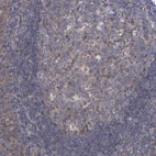 Immunohistochemical staining of human tonsil shows strong cytoplasmic positivity in germinal center cells.