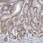 Immunohistochemical staining of human stomach shows moderate cytoplasmic positivity in glandular cells.