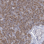 Immunohistochemical staining of human pancreas shows moderate cytoplasm granular positivity in exocrine glandular cells.