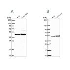 Western blot analysis using Anti-ARFGAP1 antibody HPA051019 (A) shows similar pattern to independent antibody HPA056273 (B).