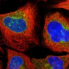 Immunofluorescent staining of human cell line U-2 OS shows localization to nuclear membrane, cytosol, the Golgi apparatus & vesicles.