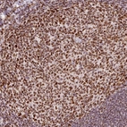 Anti-HNRNPC Antibody