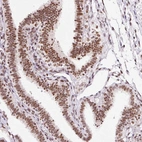 Immunohistochemical staining of human fallopian tube shows strong nuclear positivity in glandular cells.