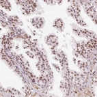 Immunohistochemical staining of human prostate shows moderate nuclear positivity in glandular cells.