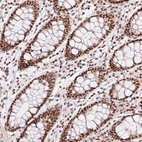 Immunohistochemical staining of human colon shows strong nuclear positivity in glandular cells.