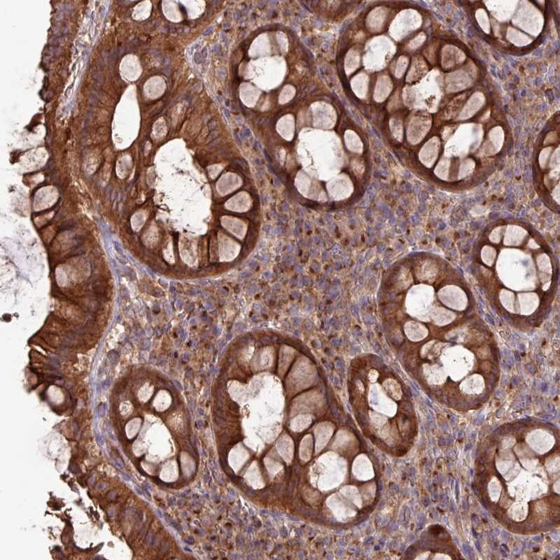 Anti-RAB19 Antibody