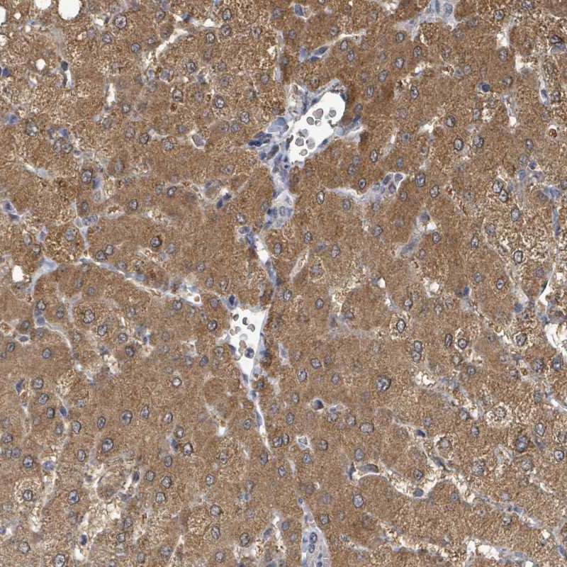 Anti-C6orf52 Antibody
