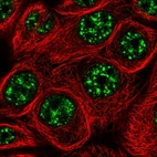 Immunofluorescent staining of human cell line MCF7 shows localization to nuclear speckles.