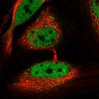 Immunofluorescent staining of human cell line HeLa shows localization to nucleoplasm & cytosol.