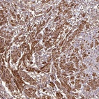 Anti-MAP3K6 Antibody