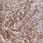 Anti-MAP3K6 Antibody